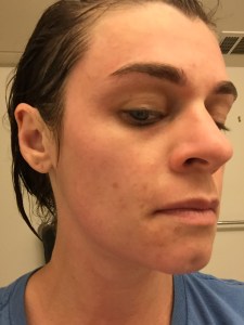 immediately after rinsing; mask left on for 45 mins.